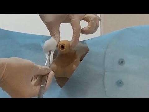 Urinary Catheterization / შარდის ბუშტის კათეტერიზაცია(მამაკაცებში)