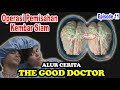 Operasi Pemisahan Otak Kembar Siam - Alur Cerita The Good Doctor EPS 11