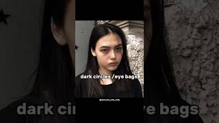 &quot;remove eye bags without any product&quot;#eyebags#darkcircles #skincare#beautytips#aesthetic #fvpシ#viral