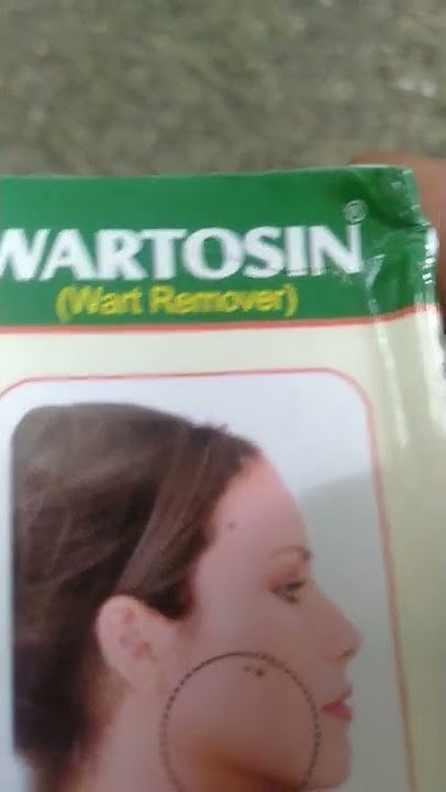 Wartosin wart Remover review shorts YouTube wartosin-wart-remover-review-shorts-youtube