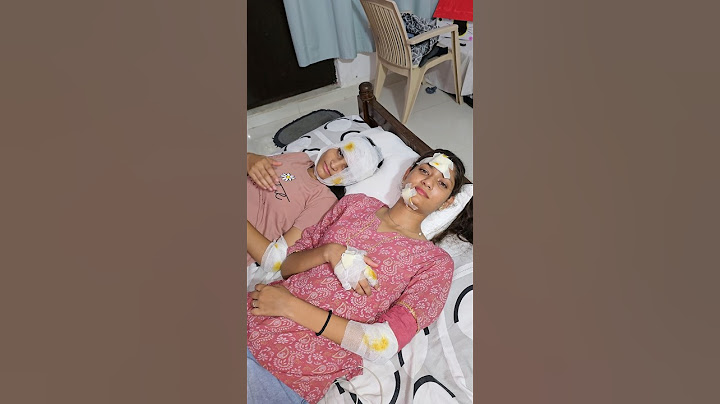 Accident ho gaya😨|#shorts #ytshorts #minivlog #trending #dailyminivlog