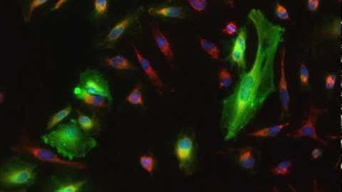HeLa Actin GFP Latrunculin Time-lapse