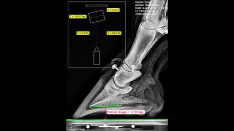 Palmar Angle Measurement Robustness