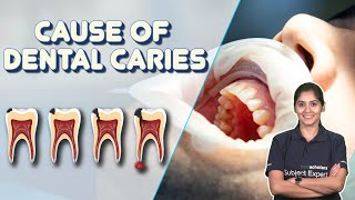 Dental caries Class -10 Science | Cause of Dental Caries | causes tooth decay? | Grade 10 Biology