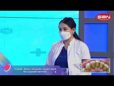 Видео: Муур дахь амны хөндийн хавдар (Gingiva Fibrosarcoma)