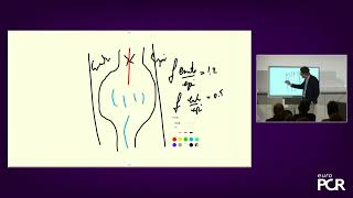 Start treating refractory angina patients with Reducer therapy - Practical aspects - EuroPCR 2022