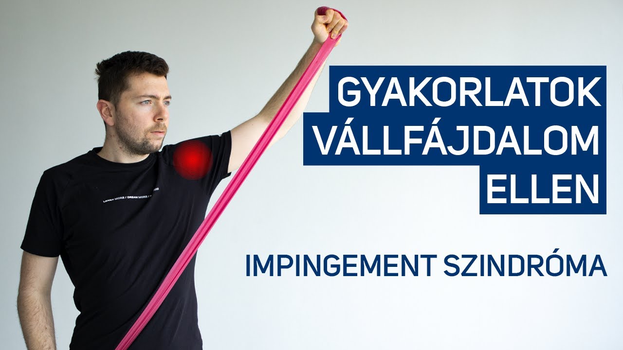 impingement szindróma gyógytorna gyakorlatok)