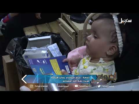 الحصبة... مرض فيروسي يمكن هزيمته