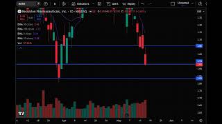 RXRX Stock (Recursion Pharmaceuticals Inc stock analysis) RXRX STOCK PREDICTION RXRX STOCK analysis