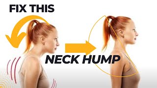 Gentle Stretching Exercises for Your Neck Pain And Neck Hump