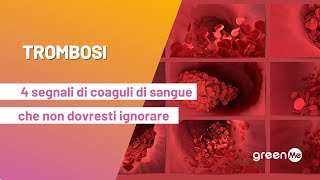 Trombosi: 4 segnali di coaguli di sangue che non dovresti ignorare