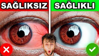 Evde Yapabi̇leceği̇ni̇z 10 Sağlik Testi̇ Akciğer Kapasitesi Sivilcelerin Anlamları Renk Körlüğü 