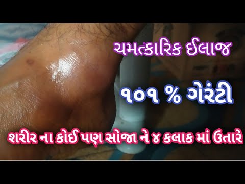 શરીર ના સોજા માટે ચમત્કારિક આયુર્વેદિક ઉપાય ૫ કલાક માં જ અસર દેખાડે મચકાઈ ગયેલ અંગો નો રામ બાણ ઉપાય