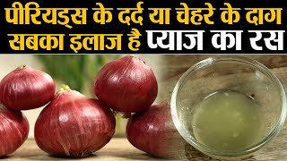 प्याज़ के रस के फायदे: पीरियड के दर्द से त्वचा सबके लिए फायदेमंद | Onion Juice Benefits | Jeevan Kosh screenshot 4