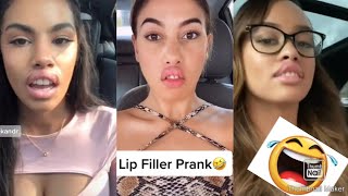 LIP FILLER PRANK ON BOYFRIEND/HUSBAND |Couple Goal | Ticktok compilation