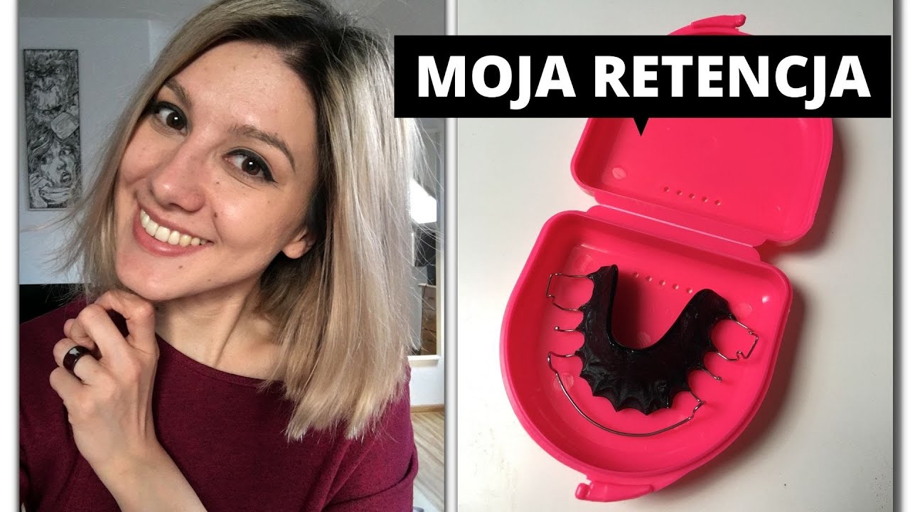 Zdjęłam aparat ortodontyczny i co dalej? RETENCJA!