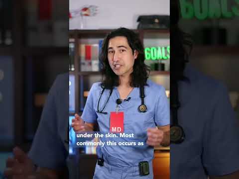 What Exactly Is A BRUISE