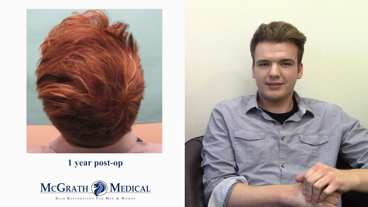 Hair Transplant Results - Case Study of Young Male Hair Loss Patient -  YouTube