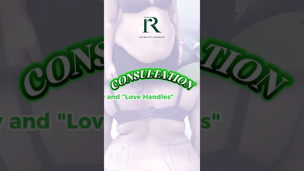 Full Abdominal Liposuction & Tummy Tuck Consultation | Maya’s Journey with R&R Beauty Aesthetic