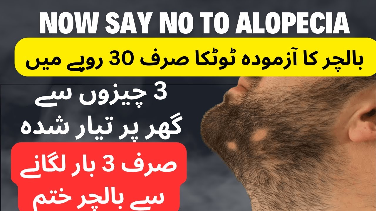 Balchar Home Remedies In Urdu|Baalchar kia hai? | Balchar ka fori ilaaj ...