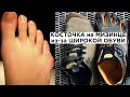 Почему появляется косточка на мизинце.Широкая обувь один из факторов