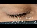 دحيه حزينه حلات وتساب ايسر العزامي