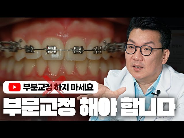 제가 좀 덜 벌면 됩니다.여러분 부분 교정 하셔도 정말 괜찮아요 [앞니 부분교정]