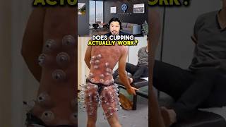 Does cupping ACTUALLY work? | Hyperarch Fascia Training
