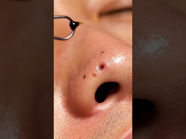 I Tried to Stop Watching… I Couldn’t