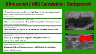 How to Characterize Soft Tissue Masses with Ultrasound (Updated 2020!) screenshot 1