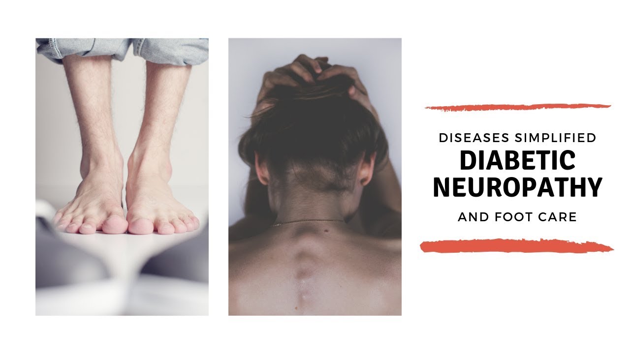 Diabetic Neuropathy and Foot Care