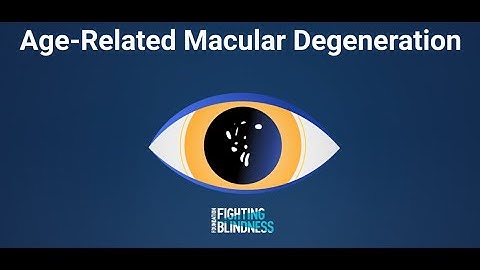 Age-Related Macular Degeneration (AMD) Explained