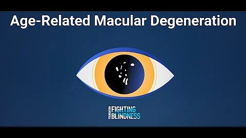 Age-Related Macular Degeneration (AMD) Explained