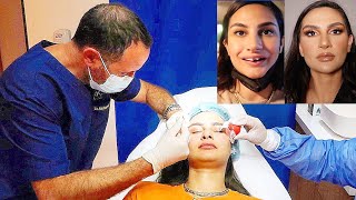 FACE TRANSFORMATION BY BEST REVIEWED DOCTORS IN DUBAI !!