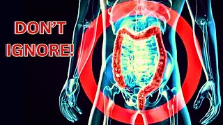 DON’T IGNORE These 6 EARLY WARNING Signs Of COLON CANCER!