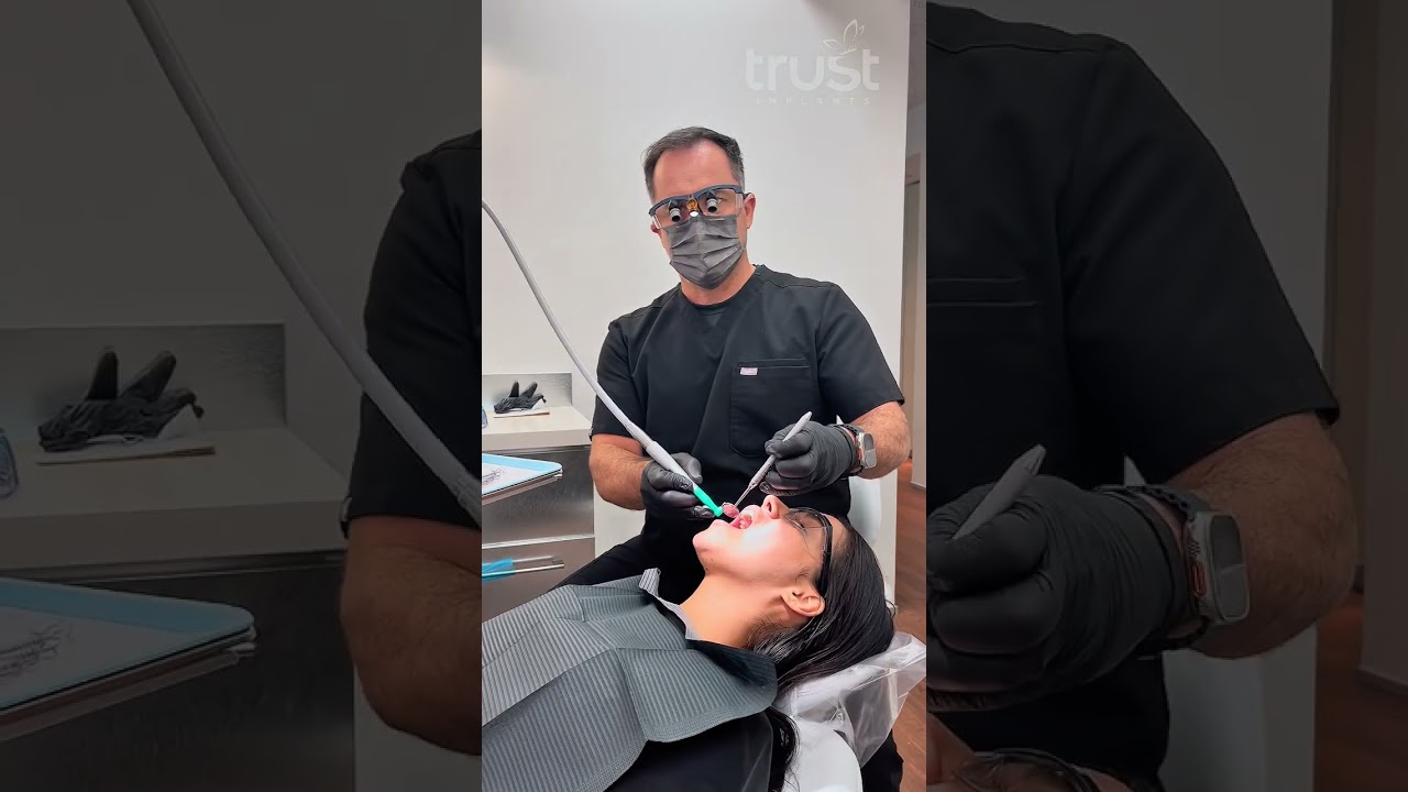 The Magic of Teeth Cleaning at Trust Implants