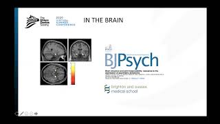 Anxiety and Hypermobility - Dr. Jessica Eccles | English (EN)