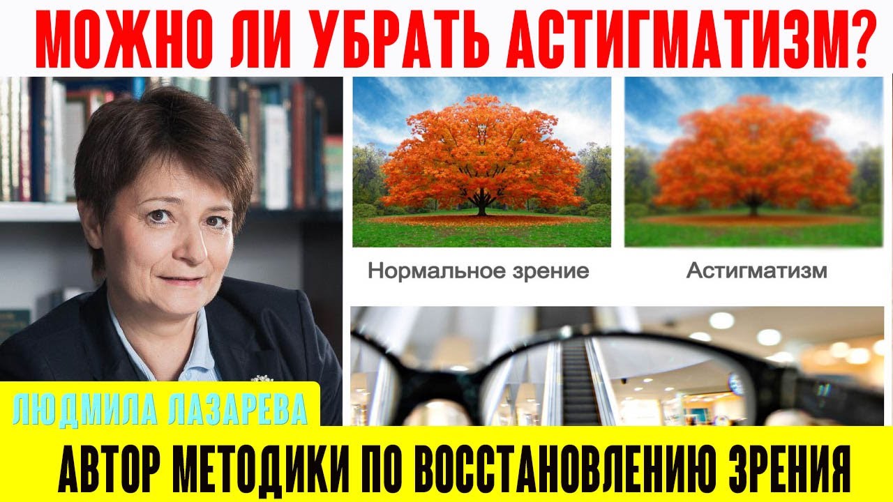 Можно ли убрать астигматизм - YouTube