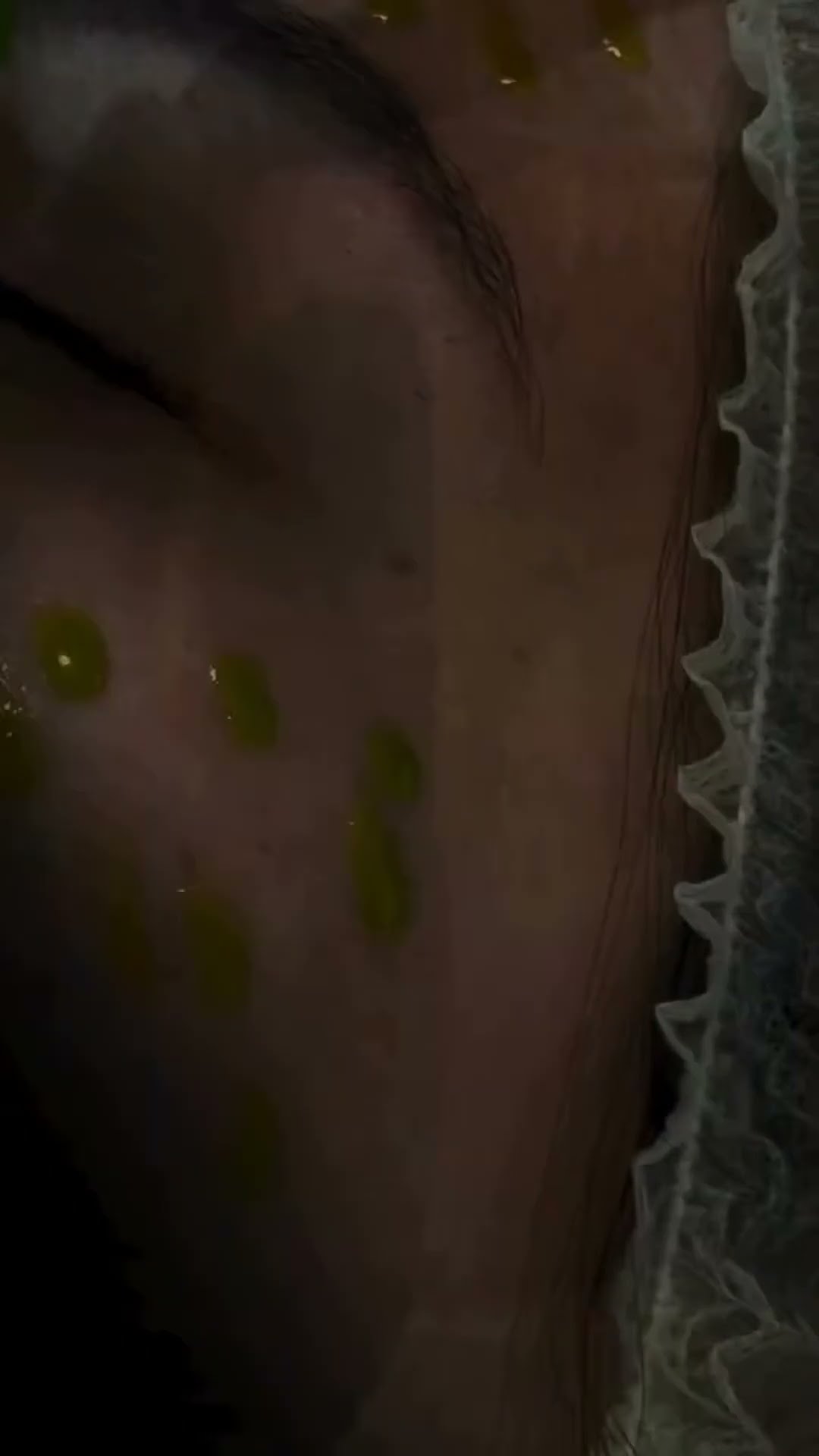 BioRePeel peel