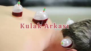 Hacamat ile Vücuttki Tüm Toksnler Atılyor! Doktrlr Bile Şaşkn Hastlıkların Gerçk Nedeni Ortya Çıktı