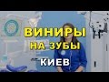 Виниры на зубы Киев,  установка виниров, фото, до и после, клиника Люми-Дент