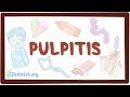 Pulpitis - causes, symptoms, diagnosis, treatment, pathology