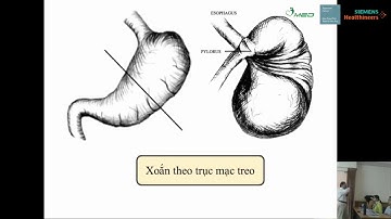 BÀI GIẢNG - SIÊU ÂM ỐNG TIÊU HOÁ NHI KHOA - HÌNH ẢNH BÌNH THƯỜNG VÀ BỆNH LÝ [BS. NGUYỄN HỮU CHÍ]