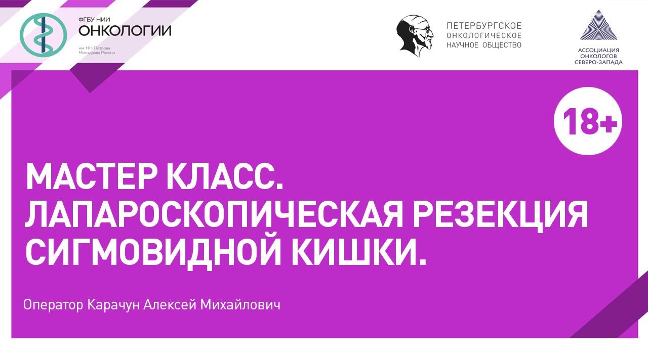 Лапароскопическая резекция сигмовидной кишки