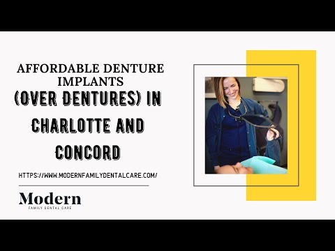 Affordable Denture Implants (Over Dentures) In Charlotte and Concord NC