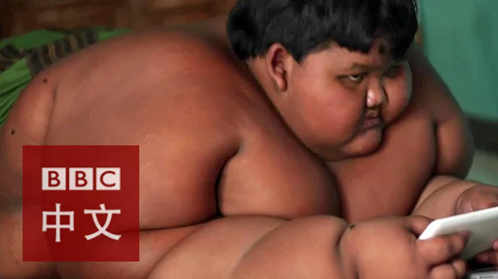 印尼二百公斤十岁男童减肥战 - 天天要闻