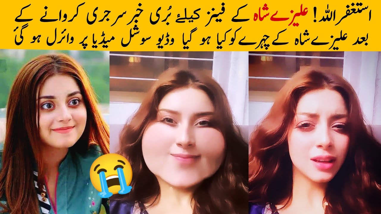 OMG😰 Alizeh Shah viral video | Alizeh shah plastic surgery went wrong ...