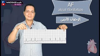 AF (atrial fibrillation) from A to Z  .. الرجفان الأذينى من الألف للياء