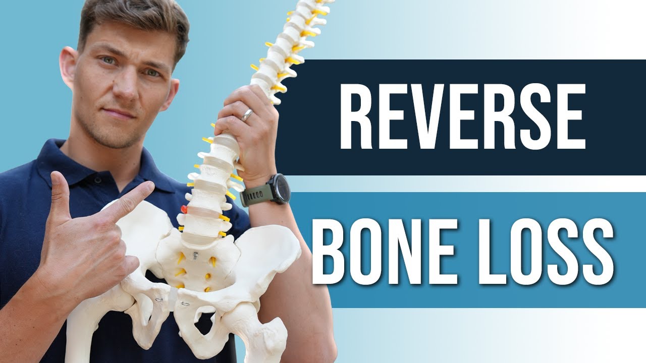 REVERSE Osteoporosis with This! (50+)