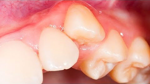 Cerrino Dis Leke Beyazlatici Aktif Karbon Kapsul Fiyati